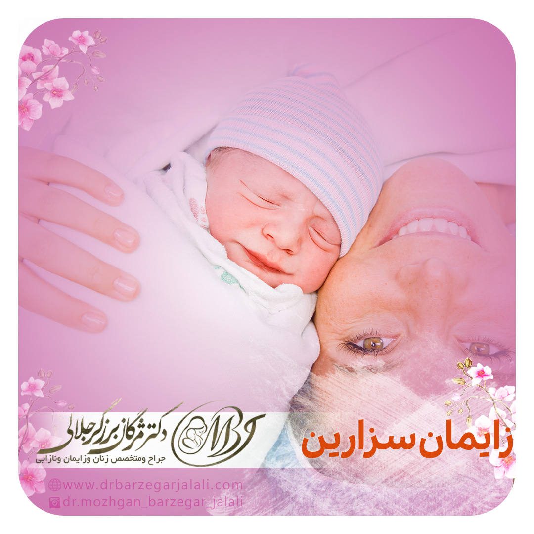 زایمان سزارین