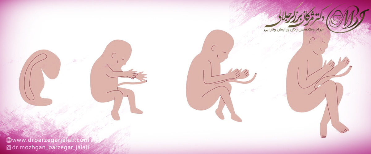 دلایل انجام سزارین اورژانسی